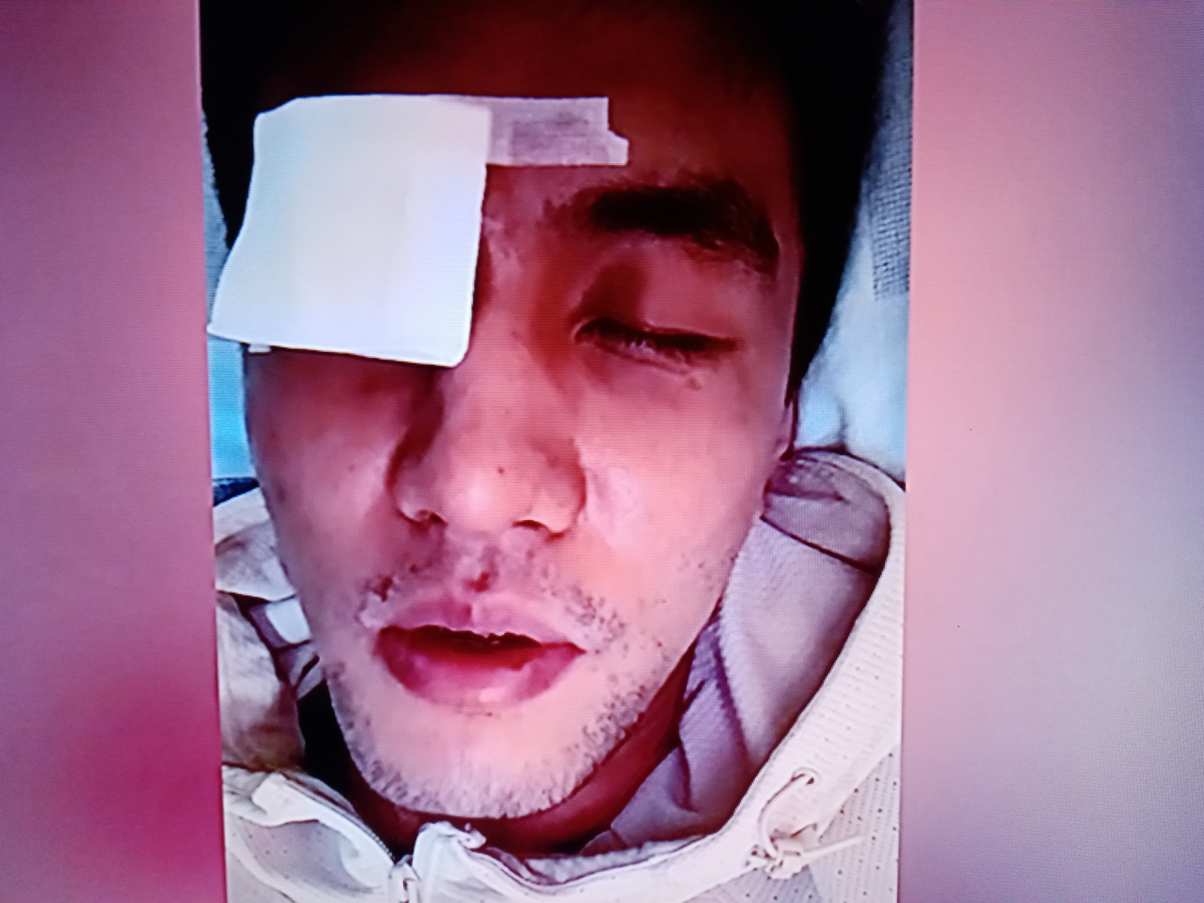 Guo Ailun was injured (the cause of Guo Ailun's injury was revealed)